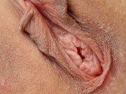 Малые половые губы большие и большой клитор